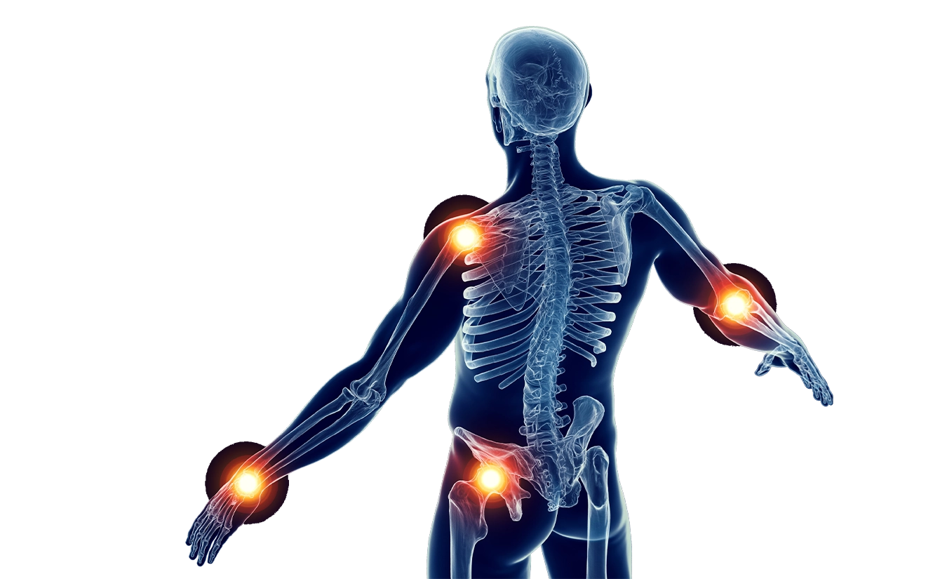  Sai cos’è il rischio di sovraccarico biomeccanico?